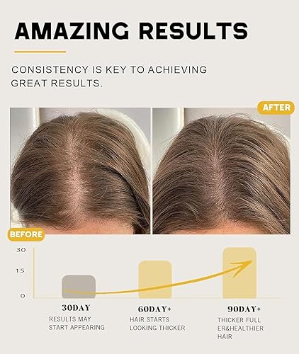 Miniatura 4 de Batana Oil for Hair Growth, 100% Natural Pure Batana Oil Paste from Dr. Sebi Honduras, Prevents Hair Loss, Enhances Thickness, Organic Raw Scalp