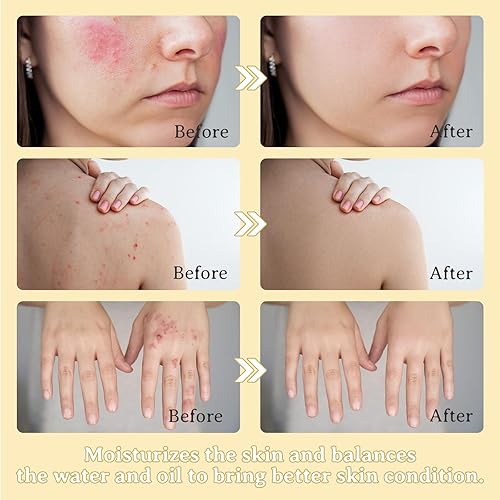 Miniatura 3 de Lionmane Sarga de ternera para la piel, bálsamo de sebo y bálsamo de miel, crema de cuidado de la piel de sarga natural 100% hierba, hidratante