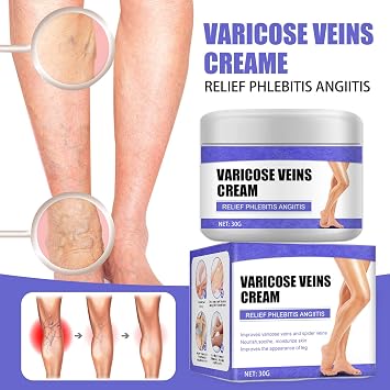 Vein Care Fading Cream, Varicose Vein Cream Leg Swelling Earthworm Leg Care Cream, Improve the Blood Circulation, Relieve Pain of Legs (2)