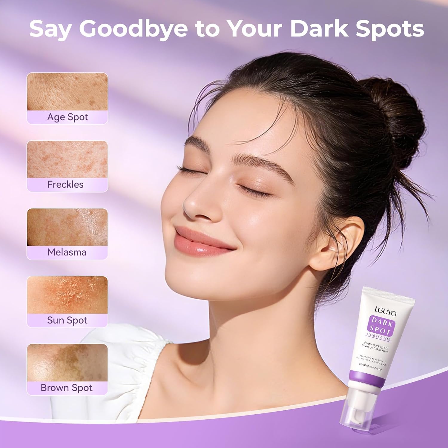 Dark Spot Remover for Face & Body - Effective Remedy for Dark Spots & Dark Spot Corrector Cream for Age Spot, Freckles, Melasma, Sun Spot - Even Toning Skin Care for Women and Men - 1.7 Fl Oz
