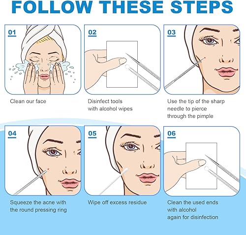 Miniatura 5 de Removedor de espinillas de acero inoxidable, extractor de espinillas, extractor de espinillas, extractor de comedones, herramienta de tratamiento de
