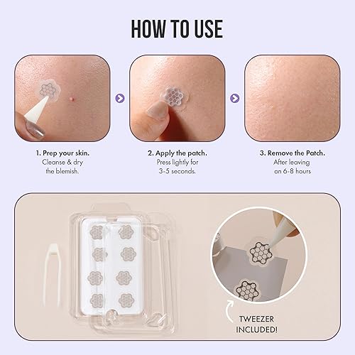 Miniatura 4 de FreeGo Parche para acné de magnesio tratamiento innovador para el acné, manchas oscuras, manchas y acné quístico - Solución puntual patentada y