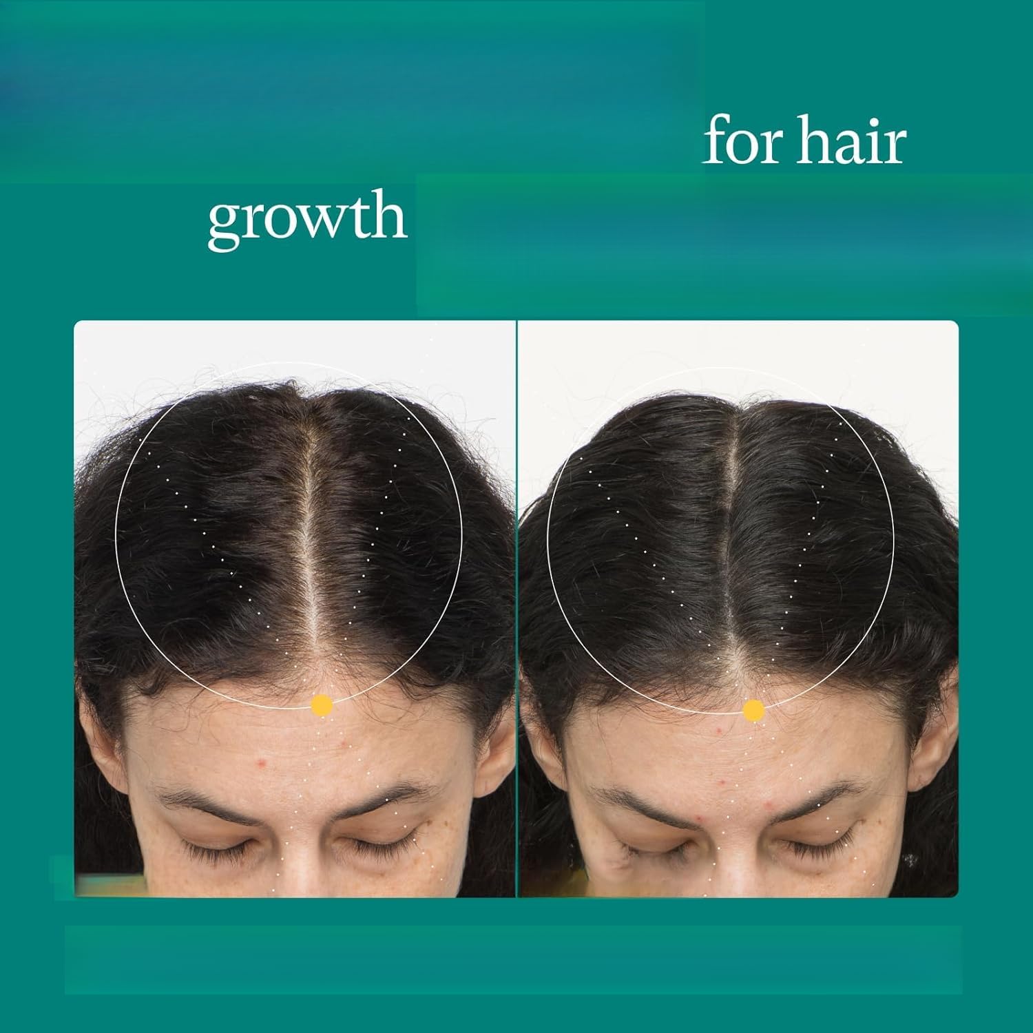 Cura quotidiana per i capelli naturali delle donne, aiuta la crescita dei capelli e li rende più spessi e forti, si adatta alle esigenze dei capelli delle donne - confezione da 2