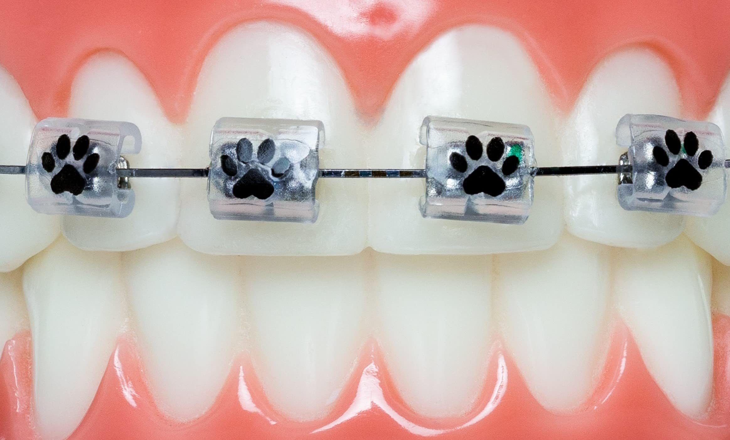 Braces Wax Alternative Bracket Cover Bumper Orthodontic Braces Accessories Paw Print 10 Ct.