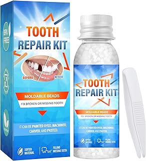 Tooth Repair Kit, Temporary Teeth Replacement Kit for Temporary Restoration of Missing & Broken Teeth Replacement Dentures, DIY Heat Fit Beads, Confident Smile