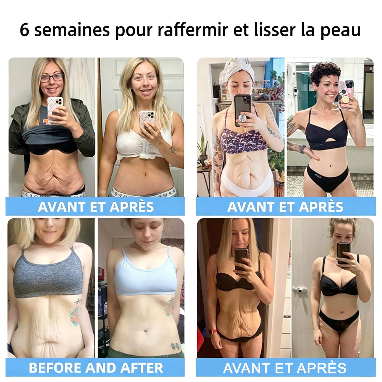 Elycura Collagène Oil, 2026 Huile Corporelle Raffermissante Magique pour Cicatrices, Rides et Vergetures, 3,38 Oz Liq (1 bouteille)