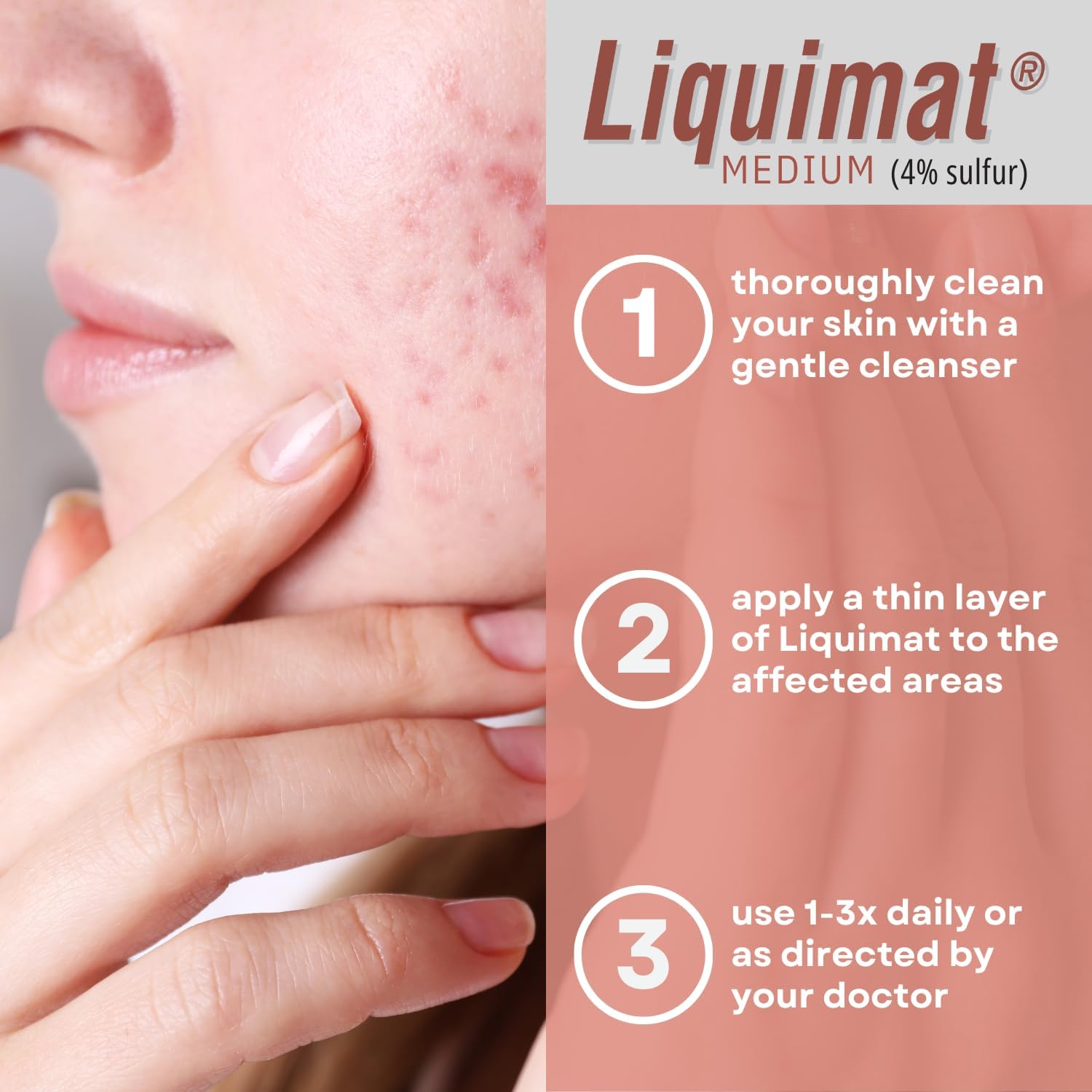 Summers Liquimat Acne Fighting Makeup Lotion, Medium, 1.5 Ounce