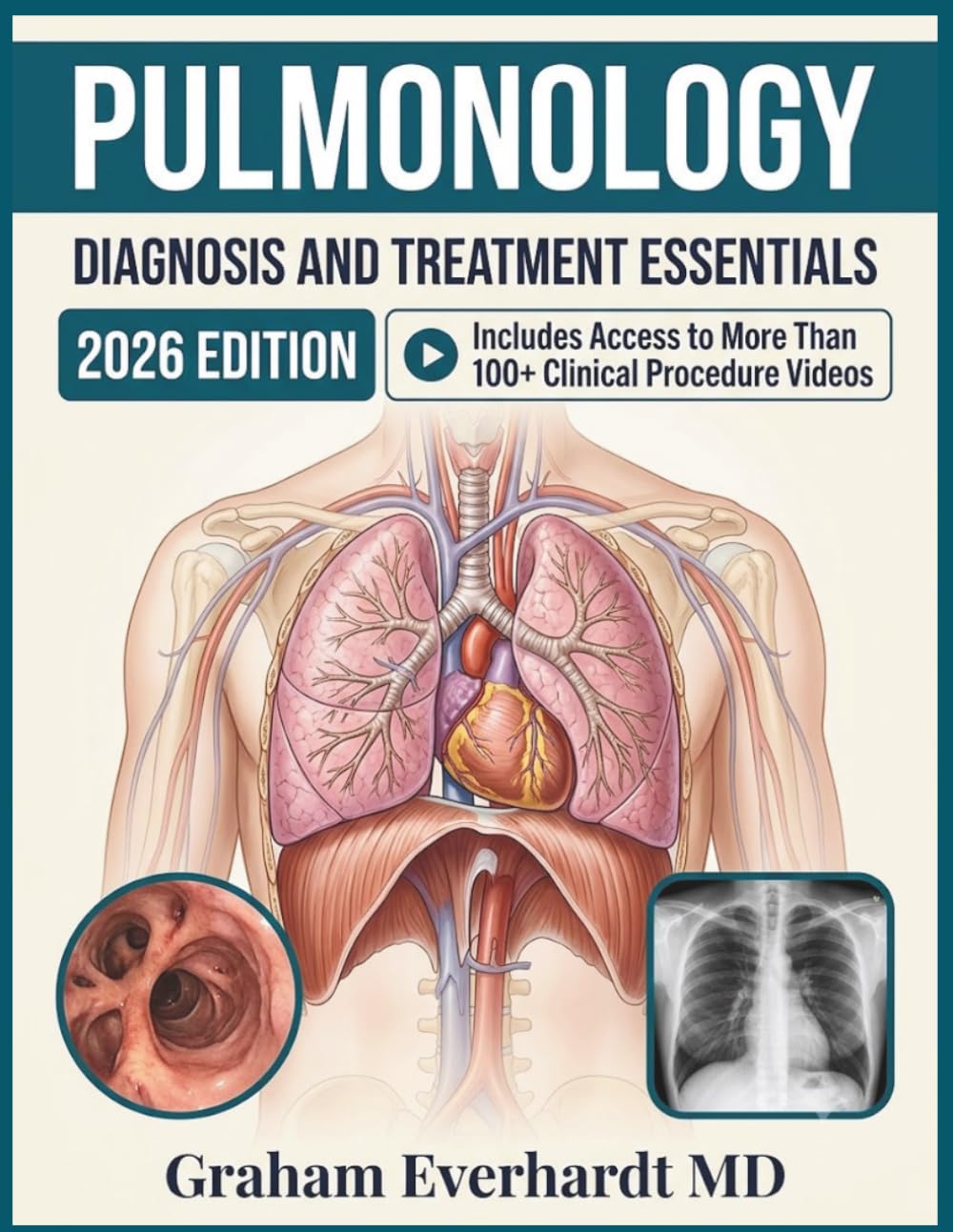 PULMONOLOGY DIAGNOSIS AND TREATMENT ESSENTIALS: A Clinical Guide to Respiratory Disease, Ventilation, and Evidence-Based Management