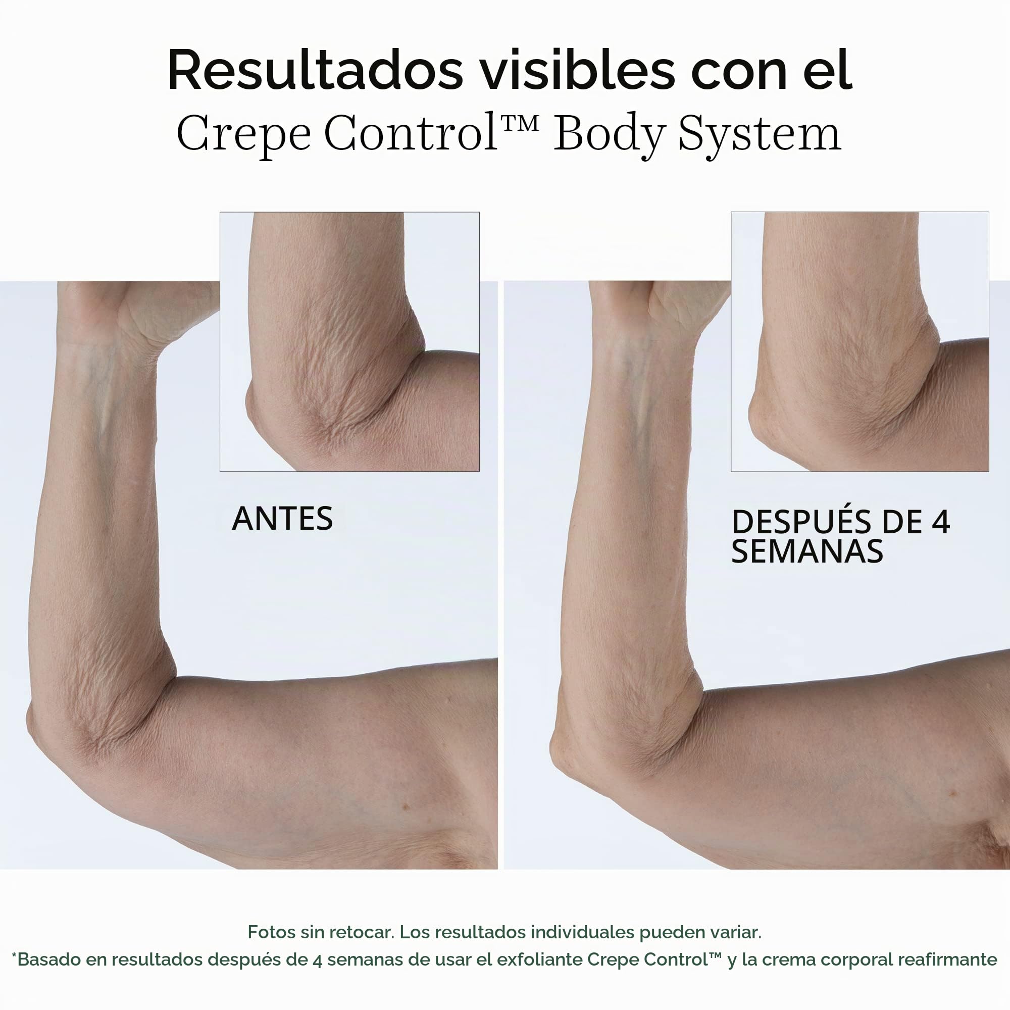 StriVectin Crepe Control Tightening Body Cream - 200 ml | Piel más firme, piel más brillante, para brazos y piernas, fórmula tensora