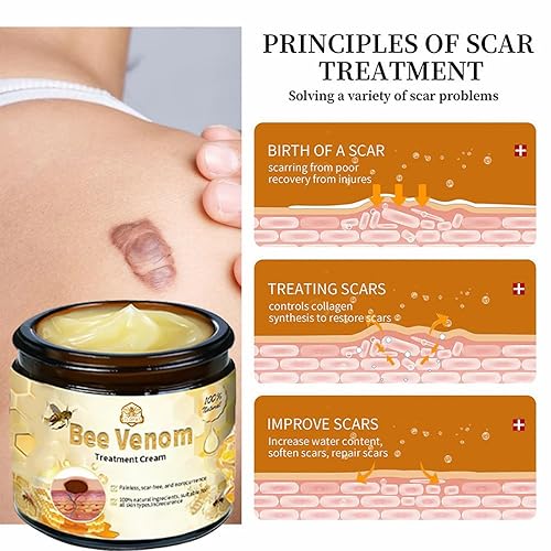 Miniatura 2 de Crema de tratamiento de piel de veneno de abeja, crema de veneno de abeja, reduce eficazmente todo tipo de manchas de la piel (1 unidad)