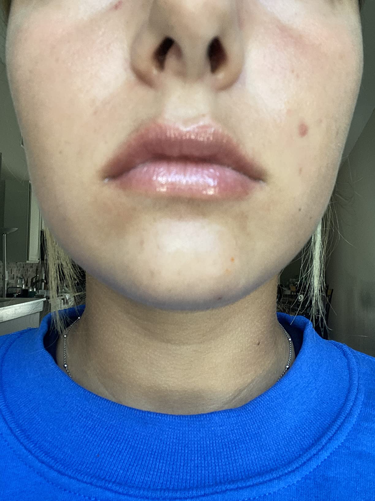Works! Just dont expect dramatic results