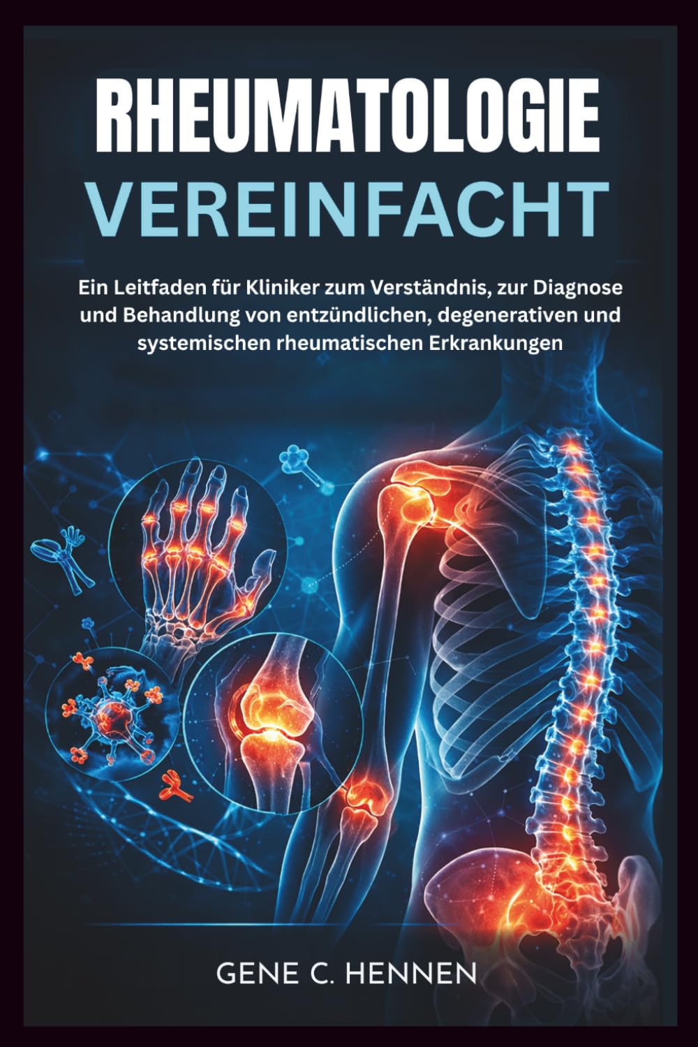 RHEUMATOLOGIE VEREINFACHT: Ein Leitfaden für Kliniker zum Verständnis, zur Diagnose und Behandlung von entzündlichen, degenerativen und systemischen rheumatischen Erkrankungen