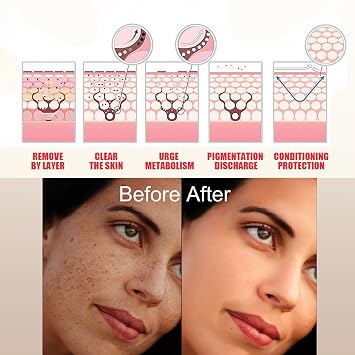 Rice 2 x Faded Serum Faded Topicals Cream Whitening Serum Topicals Faded Serum for Dark Spots Faded Brightening and Clearing Serum Faded Topical Cream Reduces Discolouration Scars and