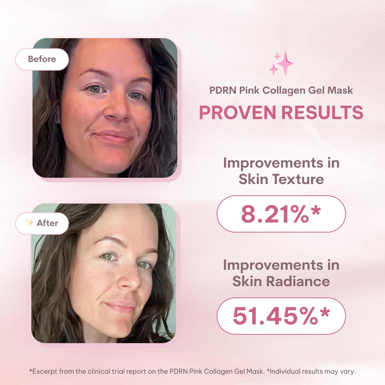 Quasi Salmon PDRN Collagen Mask - Korean Skin Care Gel Gesichtsmaske für Hydratation, Straffung & Glättung der Hautpflege, Kollagen Boost & Pore Care - 4 Masken, nicht reizend, natürliche