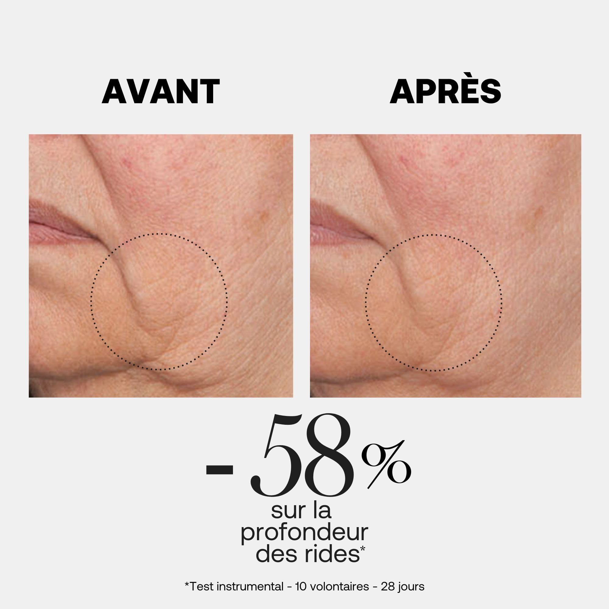 Rexaline Line Killer Rich Sérum – Huile Anti-Rides Régénérante Peaux Matures – Acide Hyaluronique RX2 & Lipopeptides DWK – Nourrit, Raffermit, Lisse – 30ml