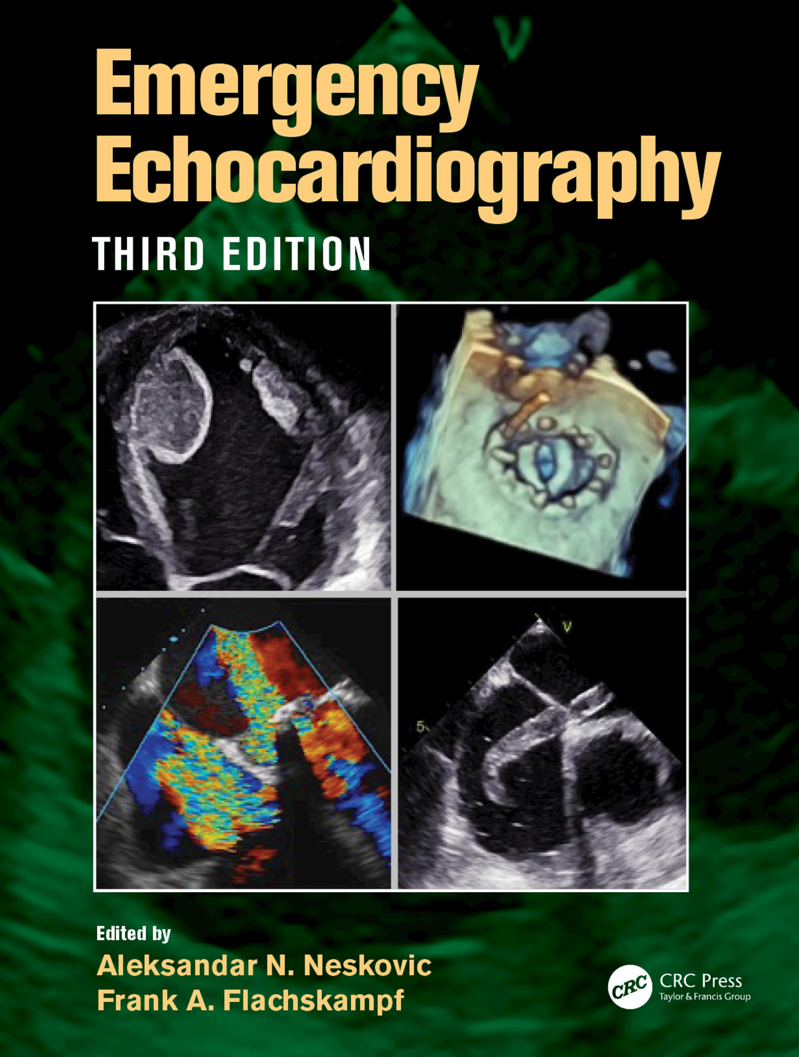 Emergency Echocardiography (English Edition)