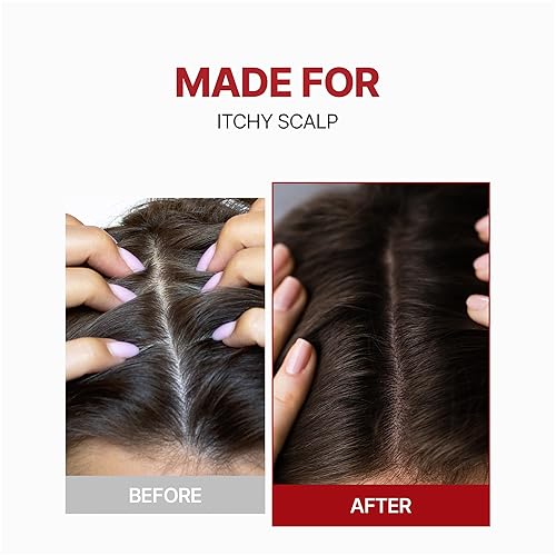 Miniatura 3 de Kundal Tónico para el cuero cabelludo con cafeína, antipérdida de cabello, alivia el cuero cabelludo, engrosamiento del cabello, estimula los