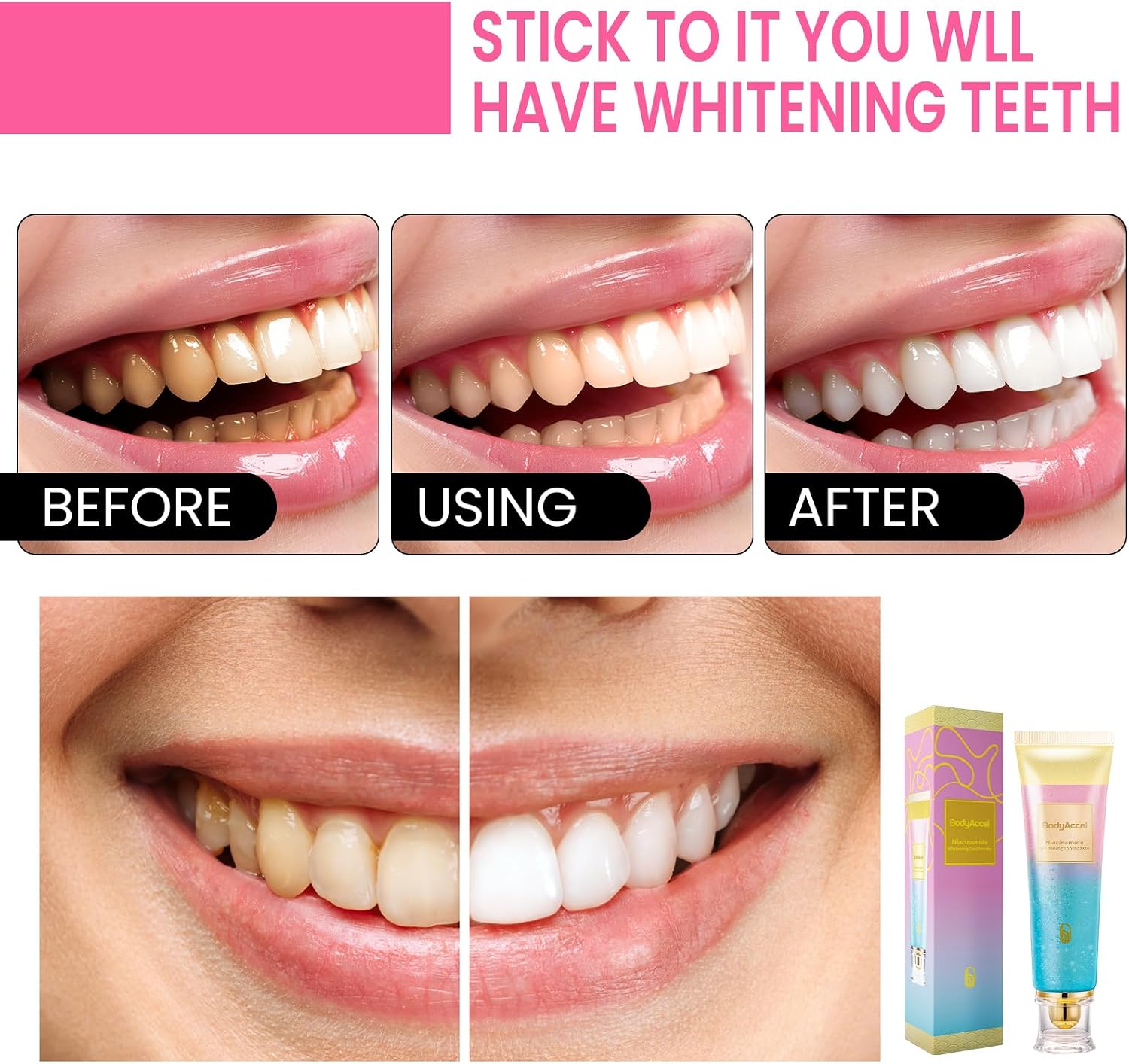 2 Pack BodyAccel Niacinamide Whitening Toothpaste, Triple Whitening Niacinamide Toothpaste, Brightens and Whitens Teeth, Natural Gentle, Fresh Breath image 4