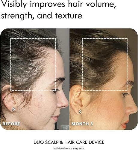 Miniatura 3 de Laduora Duo - Juego de 2 dispositivos 4 en 1 para el cuidado del cuero cabelludo y el cabello y Boost Pod  Cepillo de masaje para el cuero cabelludo