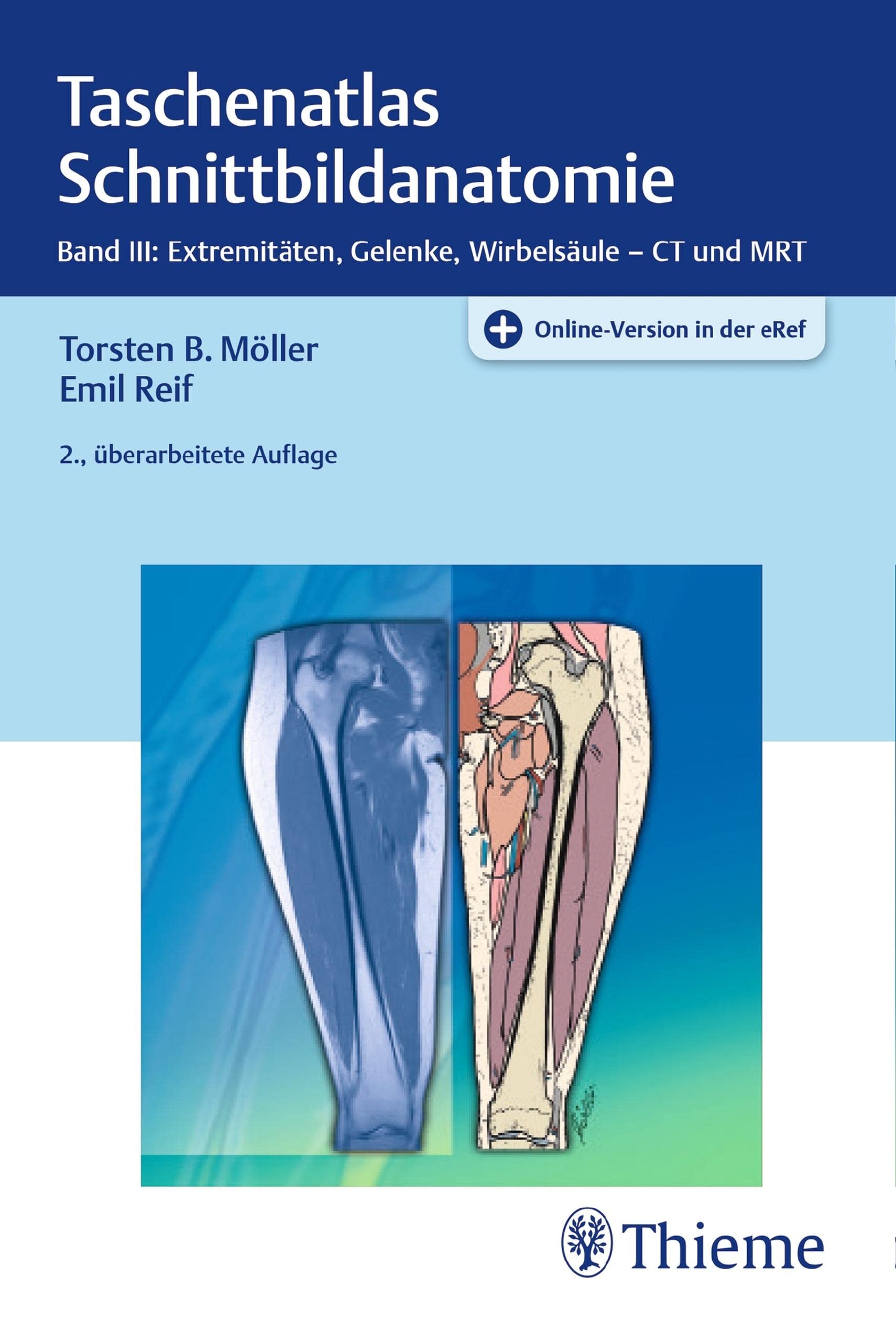 Taschenatlas Schnittbildanatomie: Band III: Extremitäten, Gelenke, Wirbelsäule