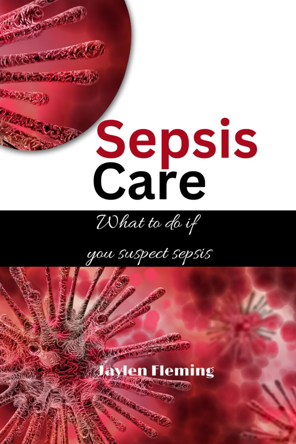 Sepsis Care: What to do if you suspect sepsis (Sepsis Syndrome Series)