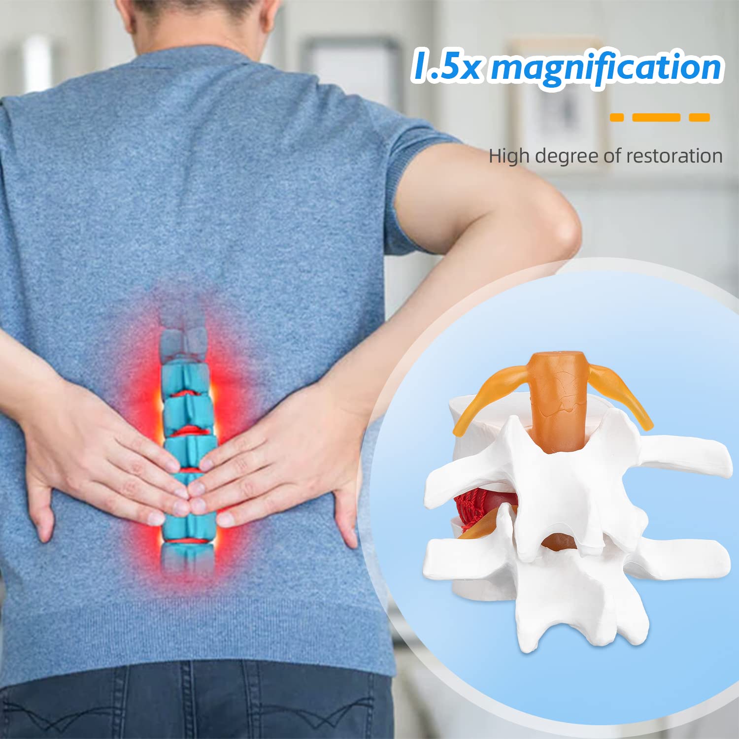 Disc Herniation Model - 1.5X Lumbar Herniated Disc Model Vertebral Spine Anatomical Medical Model