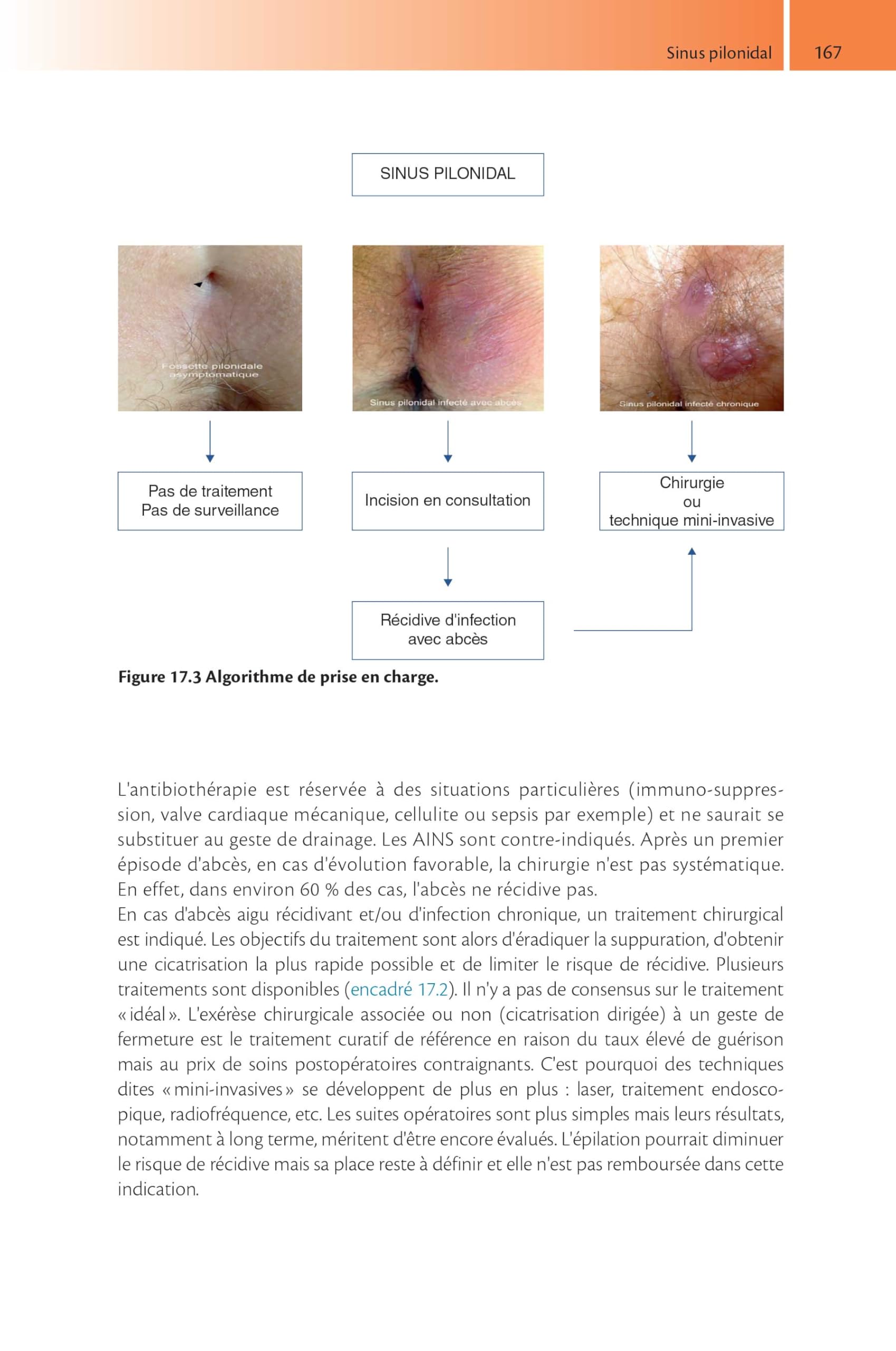 Tout-en-un de proctologie