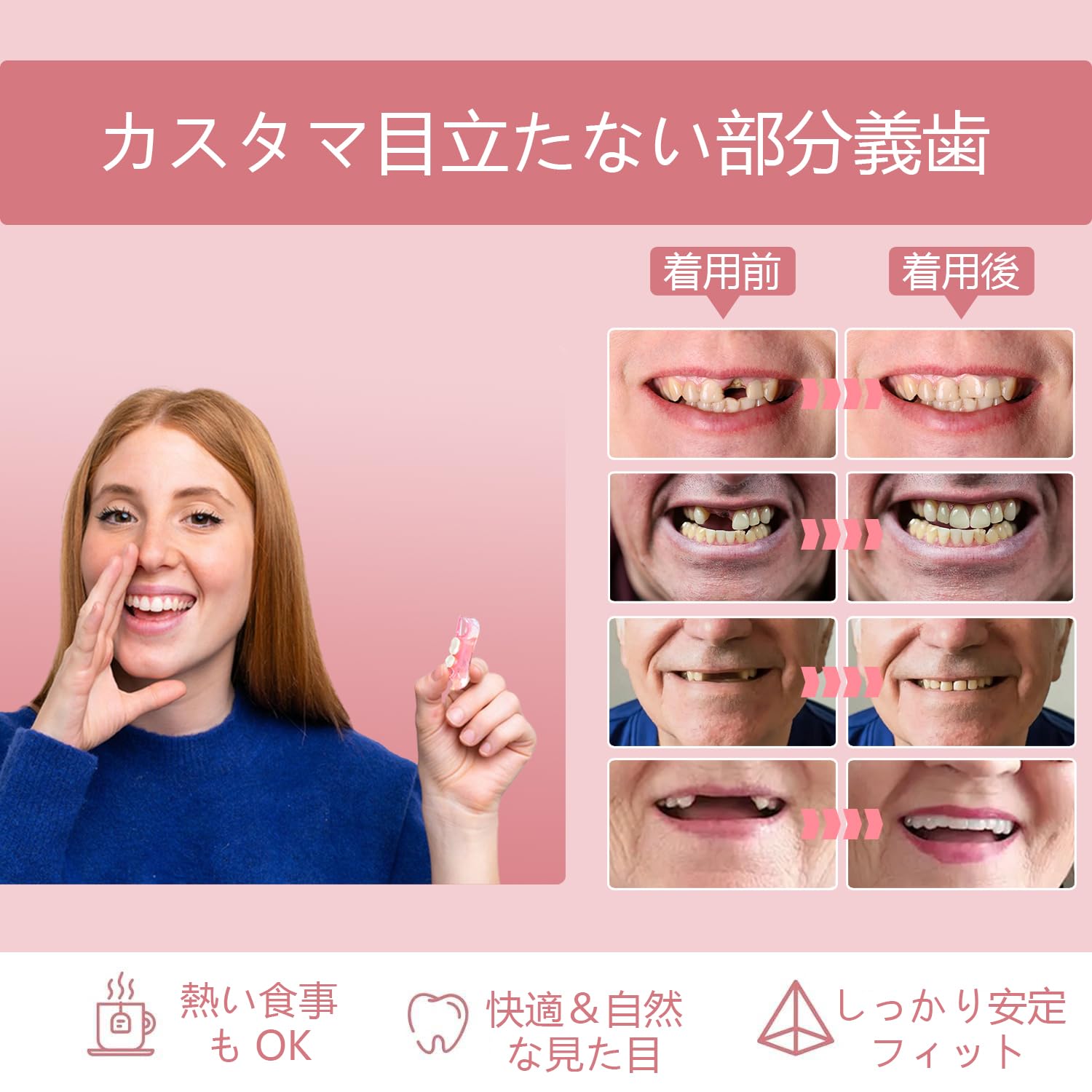 Amazon.co.jp: Miraila カスタム入れ歯 2本 部分 義歯 仮歯 差し歯対応