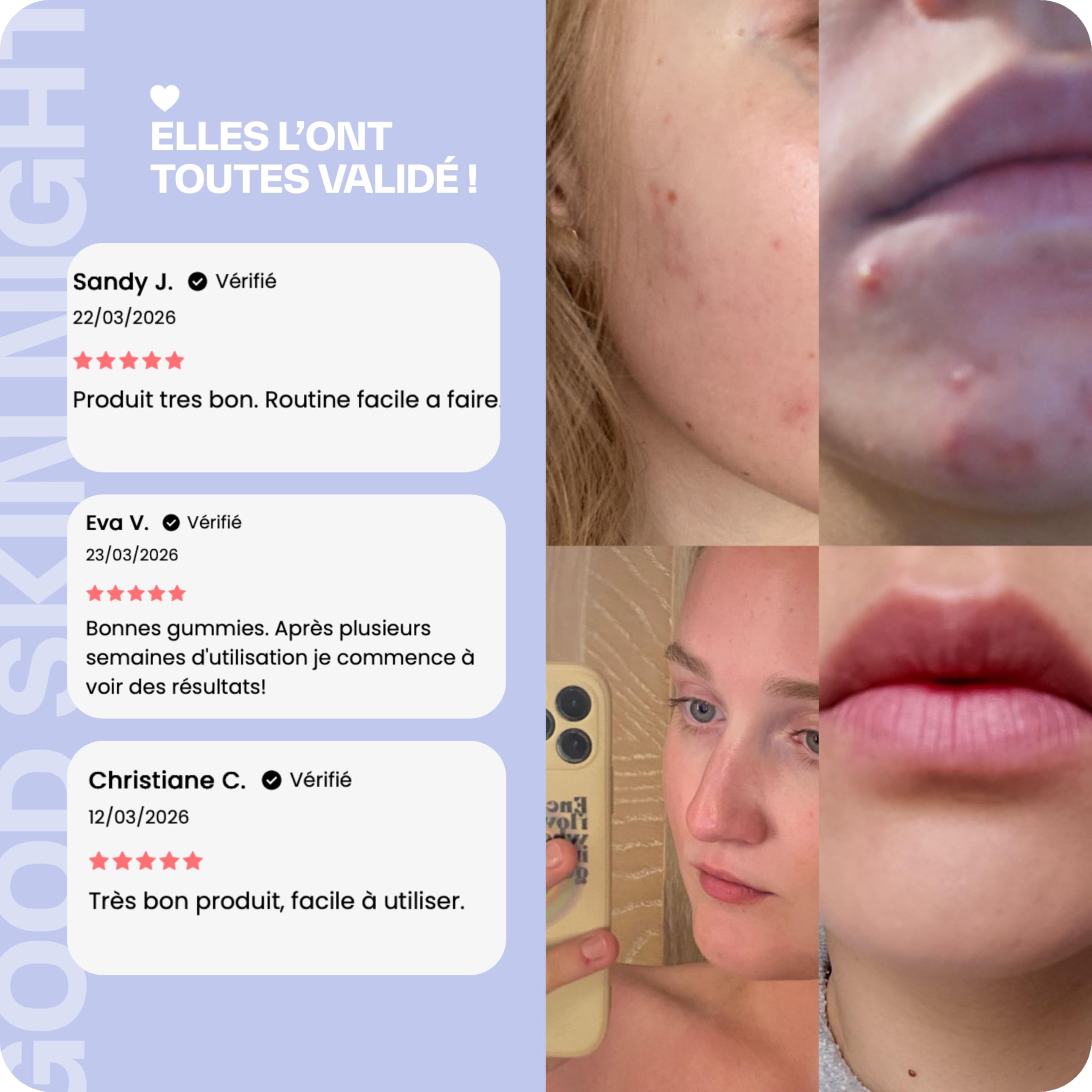 Lashilé Beauty - Complément Alimentaire - Régénérateur de peau pendant la nuit - Good Skin Night - Made In France - Coenzyme Q10 Vitamine A C Zinc - Cure 3 Mois 180 Gummies