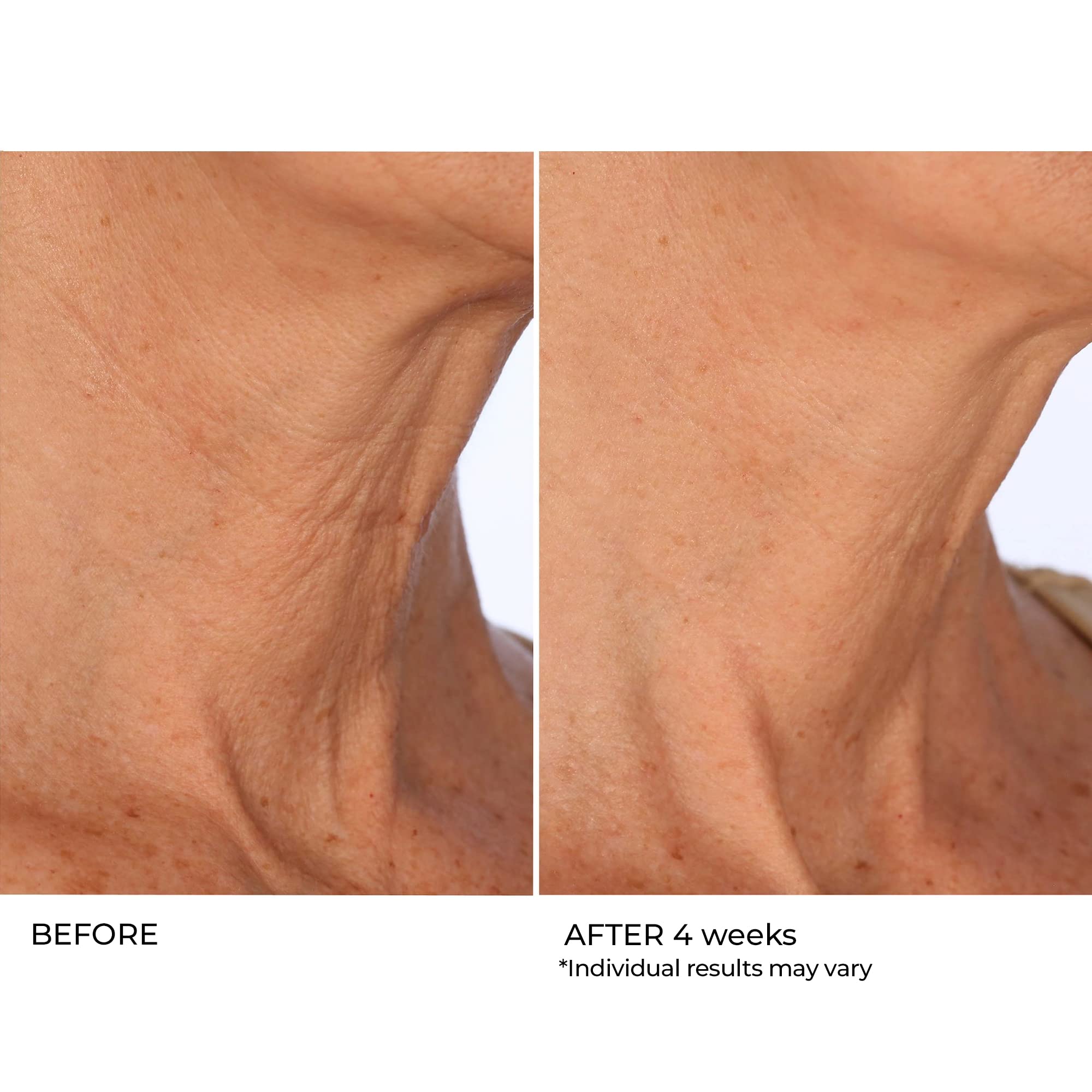 NassifMD Age Defying Neck & Décolleté Serum, Lifts and Firms Thin Neck Skin, Hydrates and Smooths