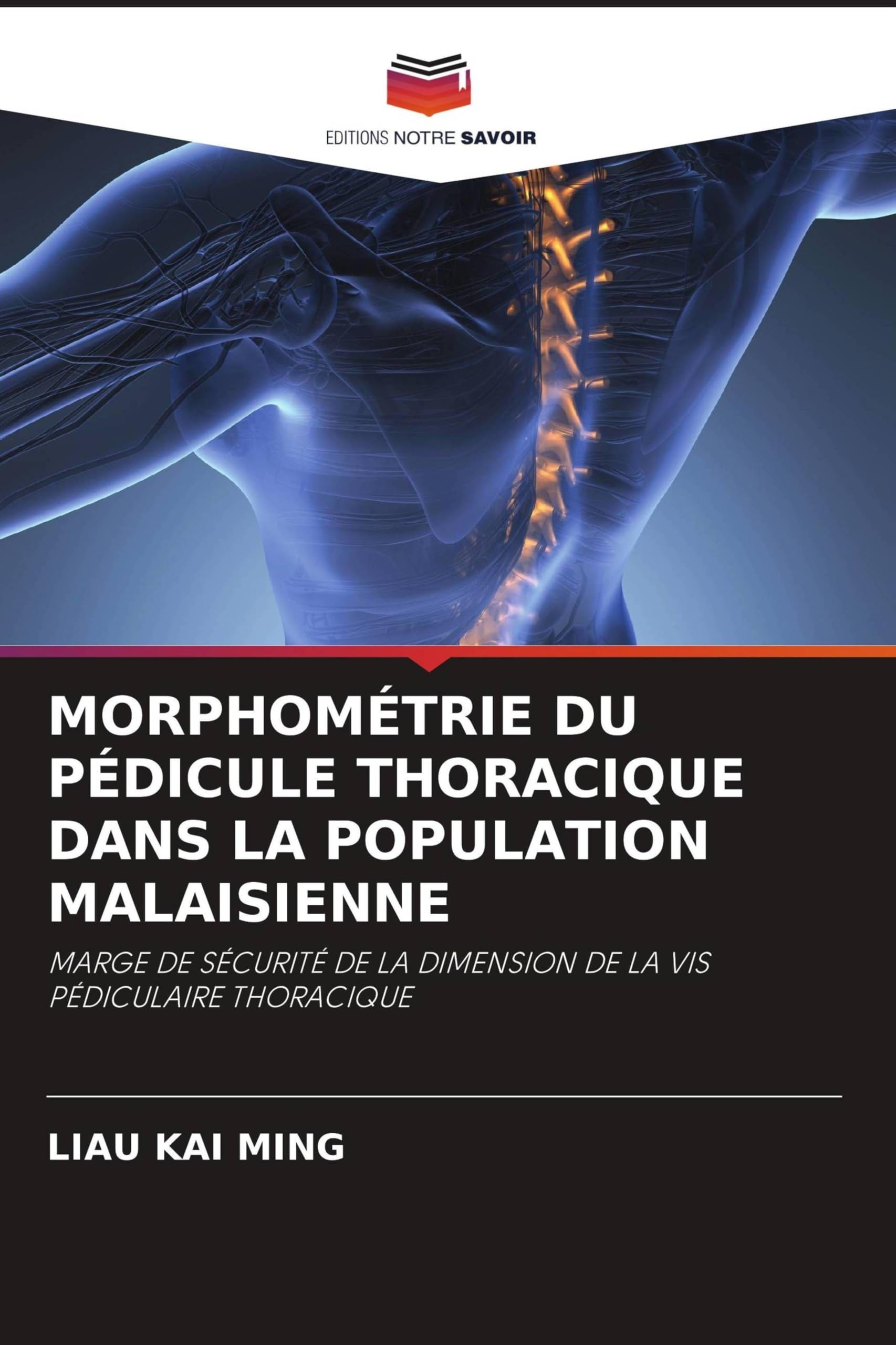 Morphométrie Du Pédicule Thoracique Dans La Population Malaisienne: MARGE DE SÉCURITÉ DE LA DIMENSION DE LA VIS PÉDICULAIRE THORACIQUE