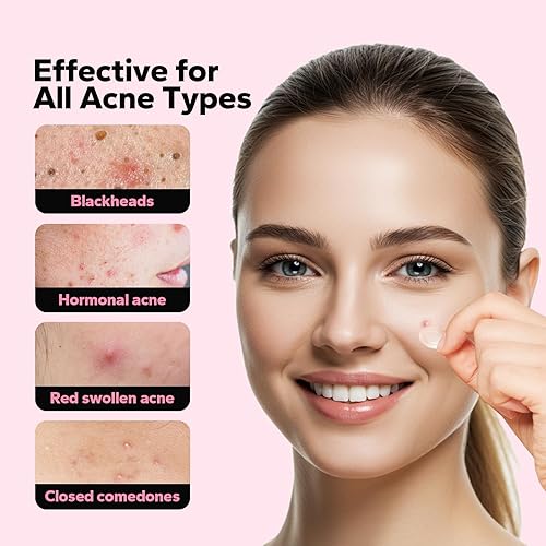 Miniatura 3 de CharmCherry Parches para espinillas para la cara (18 unidades), parches para el acné Microdart, parches hidrocoloides para manchas con ácido