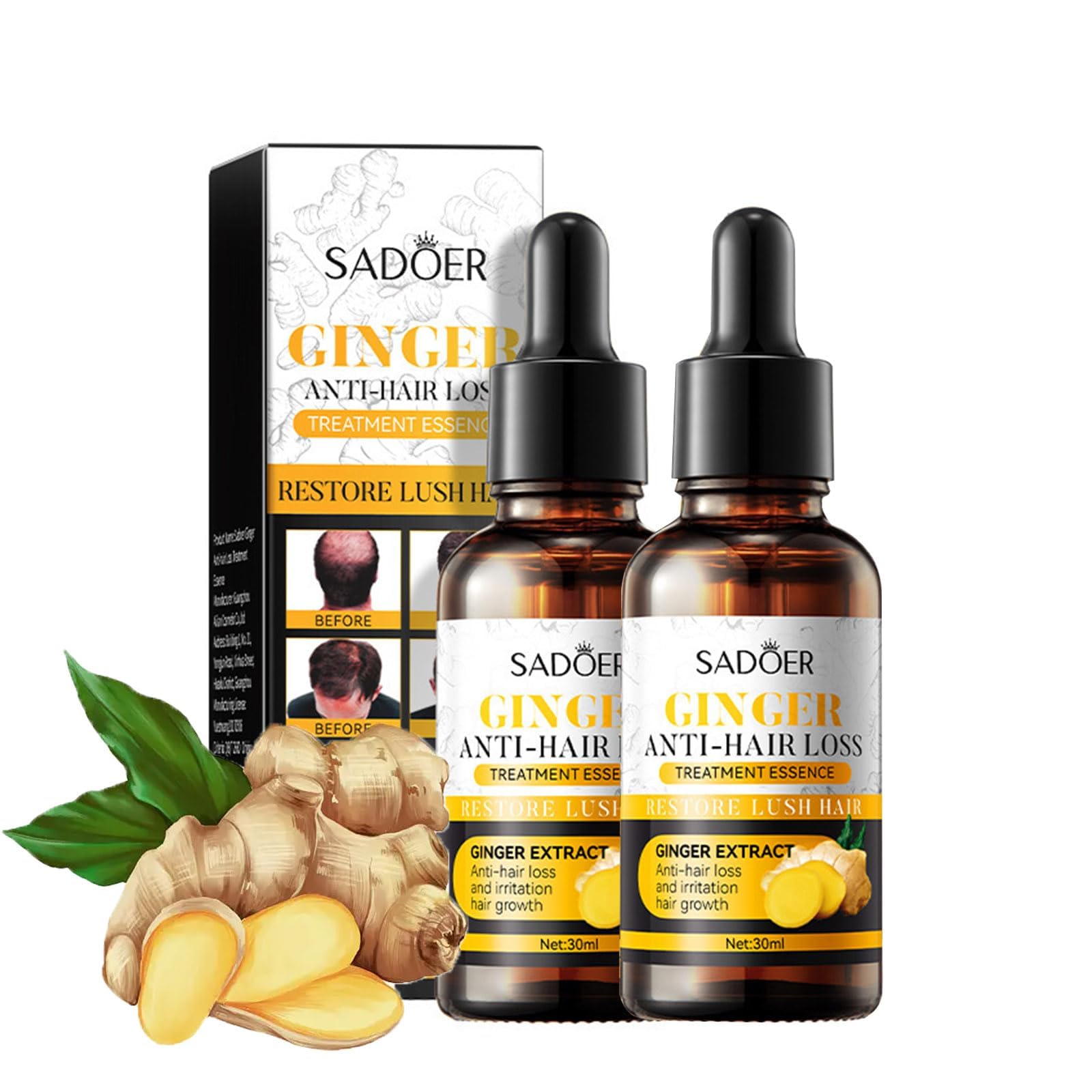 2 Pack Ginger Hair Treatment Oil, Azonee Hair Growth Serum for Hair Loss, Enhance Hair Elasticity and Toughness, Nourishes Scalp