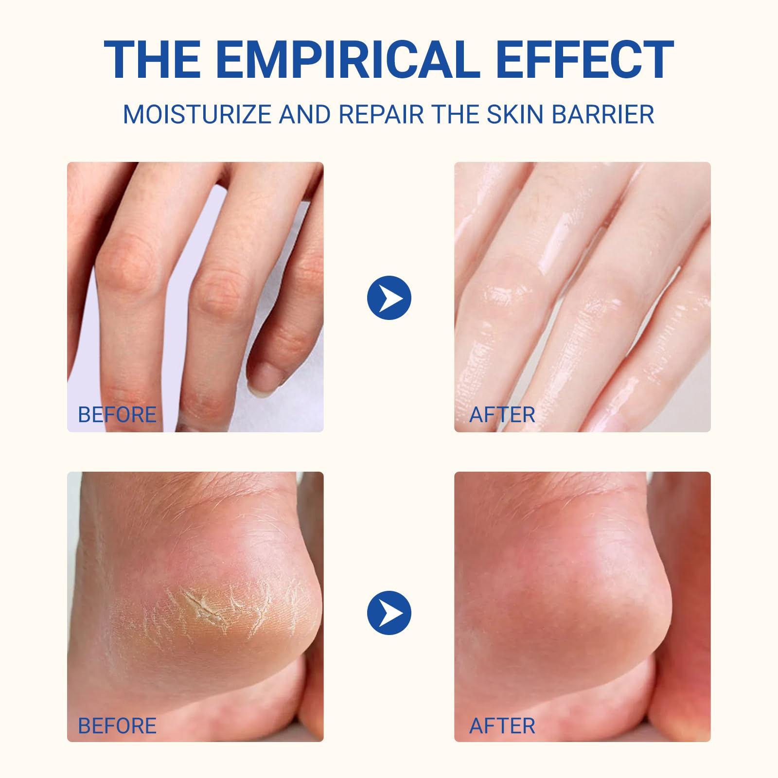 Crème à l'Urée 60% 40g, Crème pour les Pieds Secs et Fissurés, Crème Crevasse pour Talons Gercés, Crème Pieds Réparatrice Hydratante, pour Pieds Très Secs et Abîmés, avec Aloe Vera