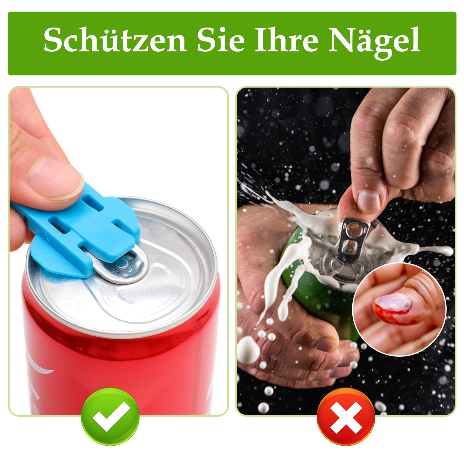 Dosenverschluss 6er Set - Getränkedeckel Für Bier, Cola & Limo Mit Insektenschutz