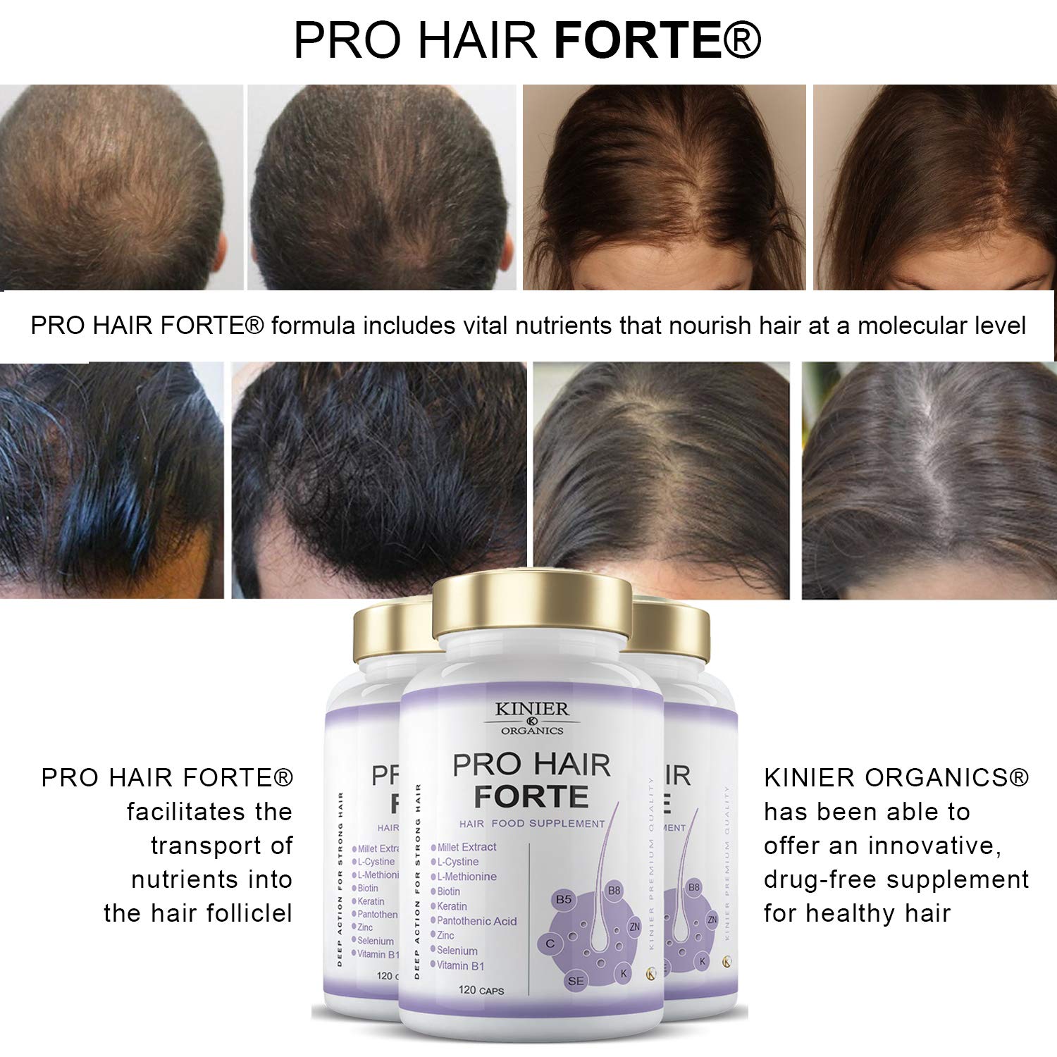PRO-HAIR FORTE - Potente Integratore per Capelli, Unghie e Pelle | Multi-nutriente - Azione Visibile |120 Capsule - Capelli Sani, Forti e Lucenti
