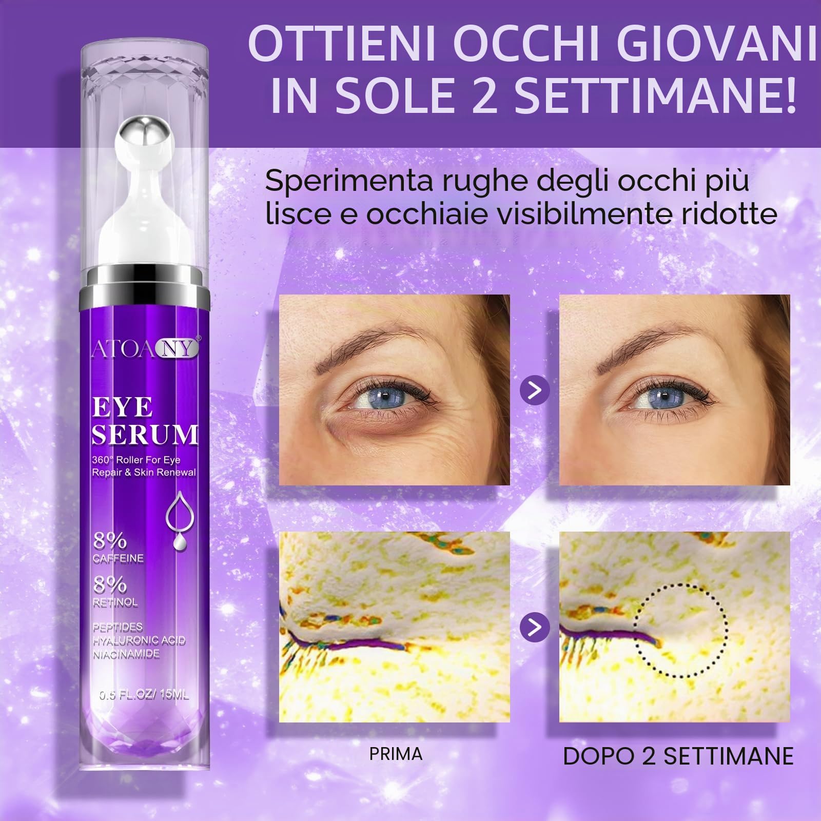 Siero per occhiaie e borse sotto gli occhi con 8% di caffeina 8% retinolo, ialuronniacinamide, anti-invecchiamento per borse e gonfiori, con pallina massaggiante a 360° per donne e uomini