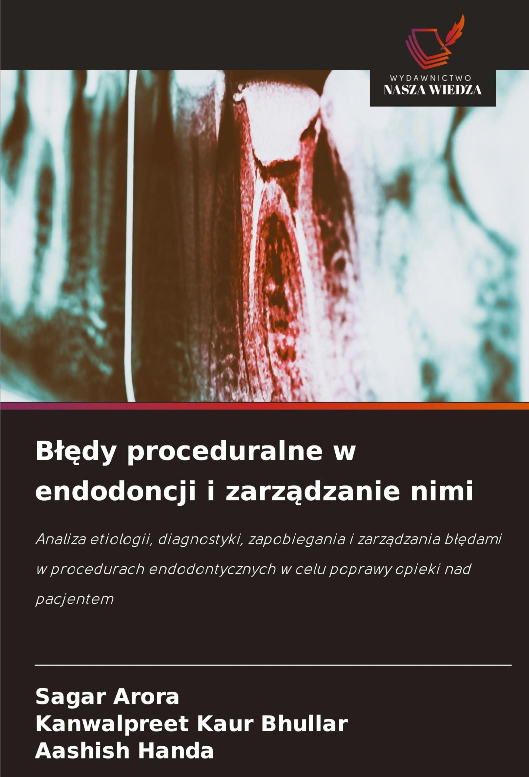 B¿¿dy proceduralne w endodoncji i zarz¿dzanie nimi: Analiza etiologii, diagnostyki, zapobiegania i zarz¿dzania b¿¿dami w procedurach endodontycznych w celu poprawy opieki nad pacjentem