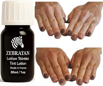 Vitiligo Made-to-Measure Make-Up   30 ml Medium Brown   Self-Tanning Lotion   Camouflage Plates