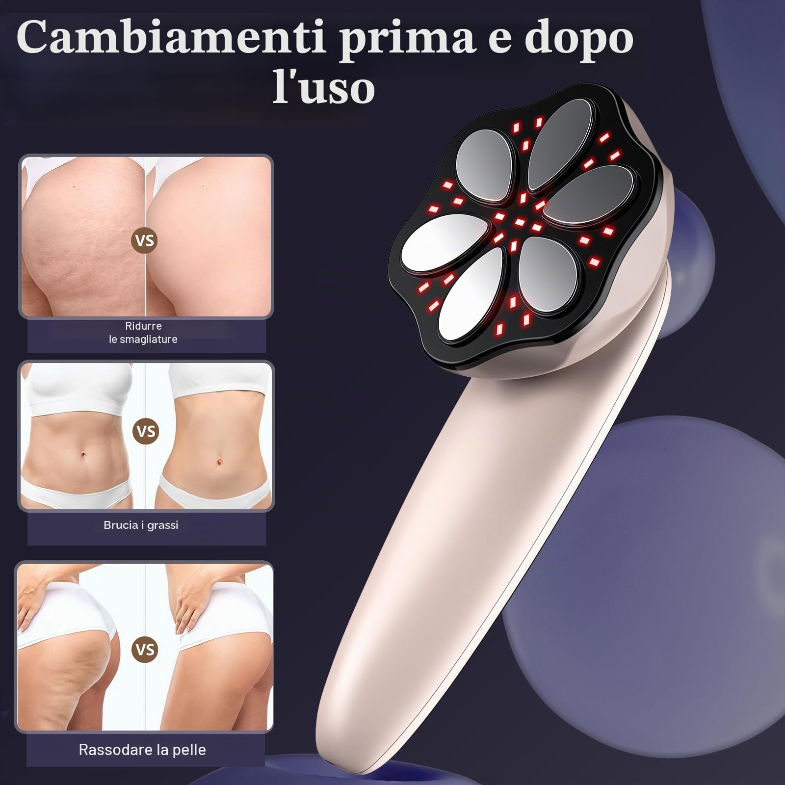 Massaggiatore Anticellulite Professionale, 3 in 1 Professionale Massaggiatore Anticellulite Elettrico per mani Pancia, Vita, Braccia, Gambe, Glutei, Unisex, Effetto lifting e rassodante