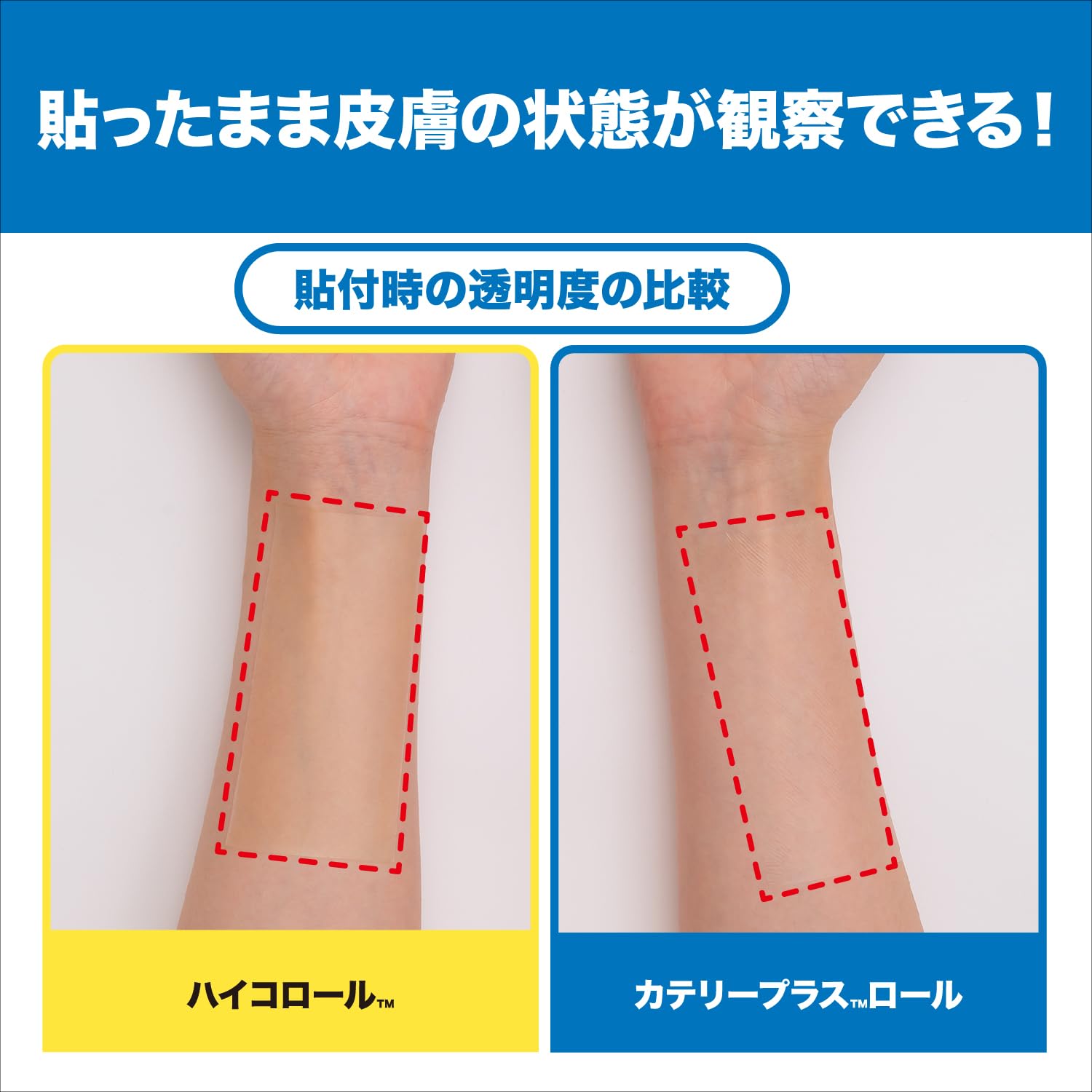 Amazon.co.jp: ニチバン 高透湿性フィルムドレッシング カテリープラス