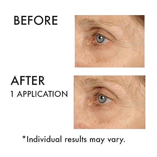 Miniatura 10 de NassifMD Hydro-Screen Suero facial de ácido hialurónico hidratante de ceramida suero de retinol ácido hialurónico hidratante suero de ceramida