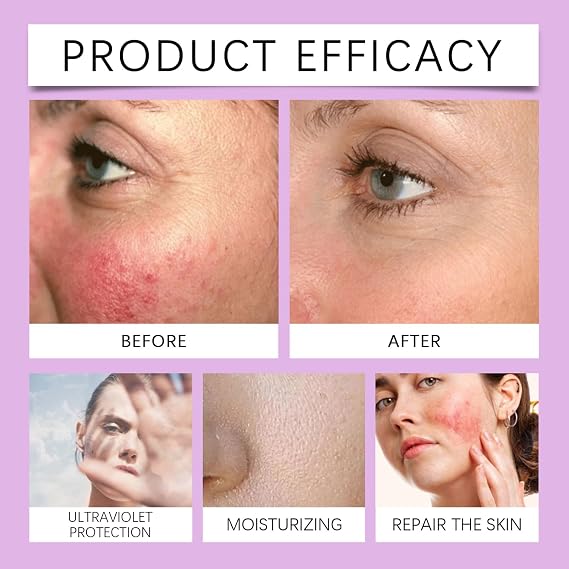 Sun Cream Spf 100 - Spf 100 Sunscreen - Uvb/Uva High Protection Spf 100 Face Moisturiser - Factor 100 Sun Screen Prevent Sunburn&Taning -Waterproof Moisturiser Soothing Skin 80g