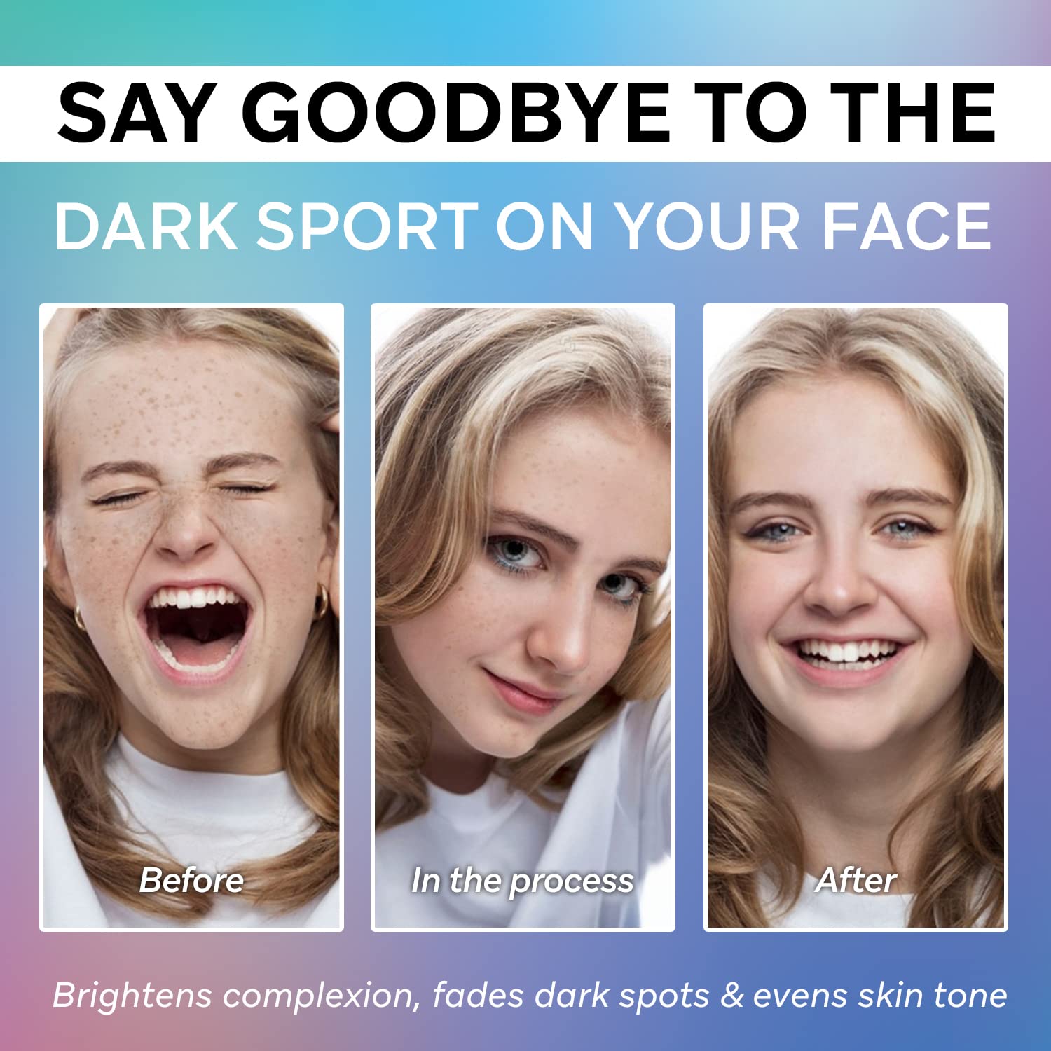 Dark Spot Remover for Face,Dark Spot Corrector Serum,Hyperpigmentation Treatment,Advanced and Natural Formula - - Removes Freckles, Sun Spots, Melasma and More
