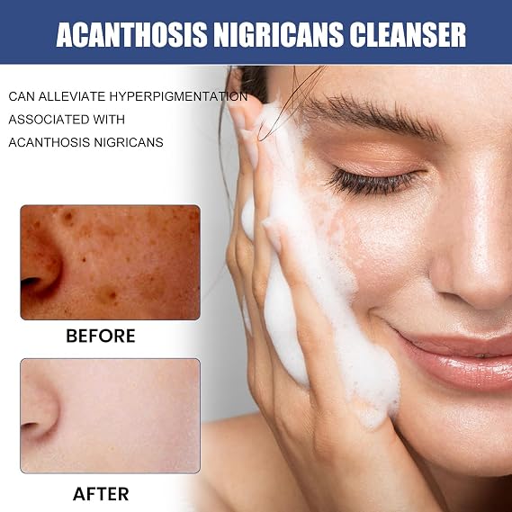 Deep-Cleansing & Nourishing Facial Cleansing Milk - Oil Control, Skin Barrier Strengthening, Brightening & Moisturizing(1PCS)