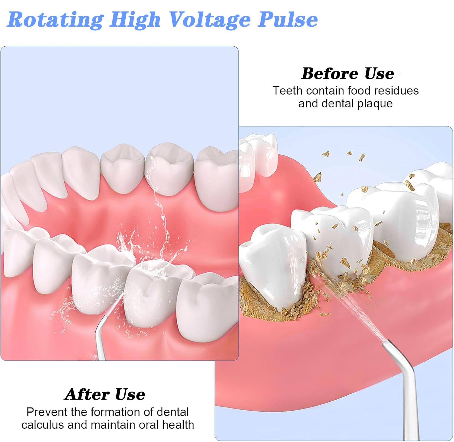 Idropulsore Dentale Portatile, Irrigatore Orale Senza Fili Impermeabile IPX7 con 3 Modalità e 4 Ugelli, Serbatoio da 380ml, Tecnologia a Impulsi e Grande Autonomia per Uso Domestico e Viaggi