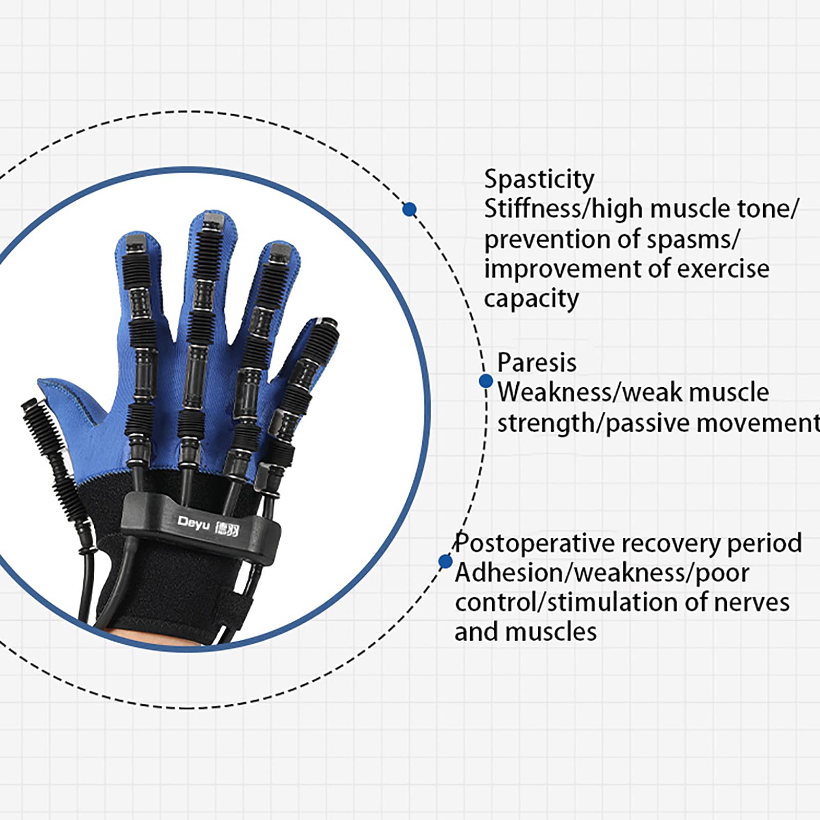 Guantes de rehabilitación para entrenamiento de dedos para recuperación de accidentes cerebrovasculares, equipo de rehabilitación para hemiplejia y terapia de manos