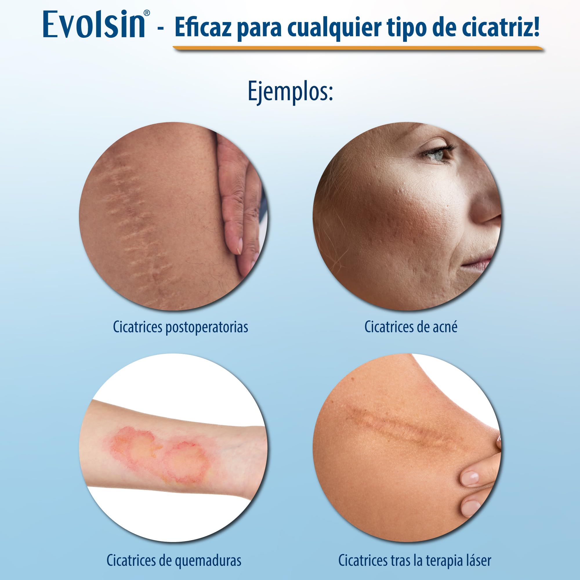 Evolsin parches cicatrizantes silicon scar sheets para cicatrices