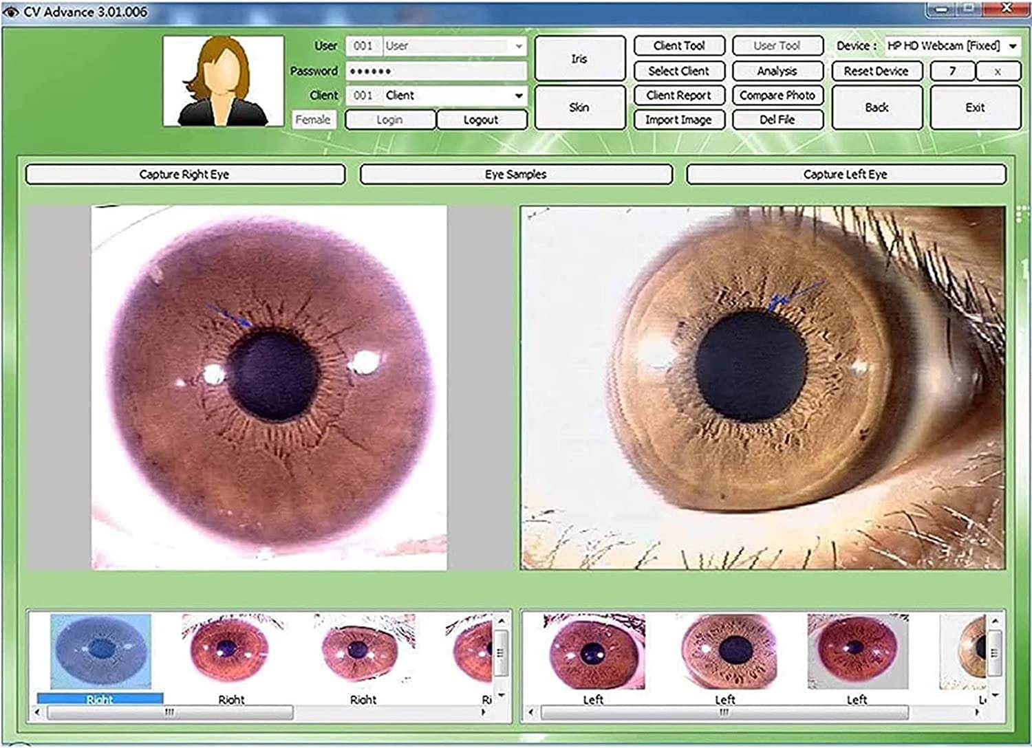 Kamera analizy IRIS,5 milionów pikseli wysokiej rozdzielczości 2560 * 1920 USB2.0 Interfejs Iriscope Diagnostic Eye Camera,z pojedynczym podwójnym sterowaniem lampy regulowaną Win7,Win8, Win10, Win11