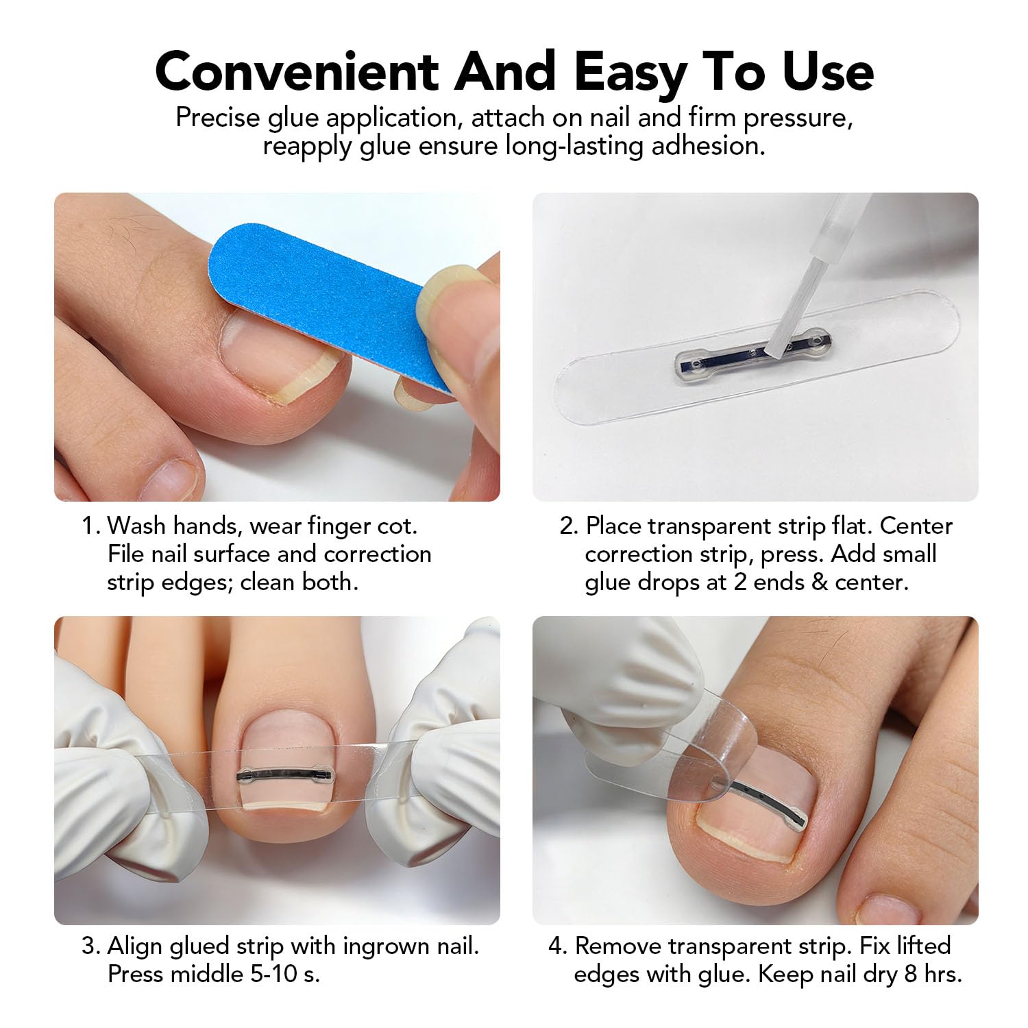 Titanium Alloy Ingrown Toenail Corrector, Upgraded Curved Toenail Quick Relief Nail Repair Treatment Kit, 12Pcs 2 Multi-Sizes Waterproof Corrector Strips for All Size Curve Correct, 0.59in&0.67in